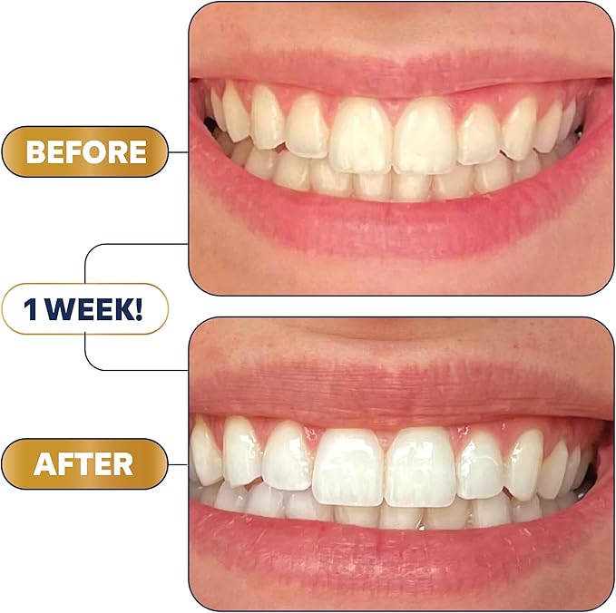 Lumineux Teeth Whitening Strips Kit - 9 Treatments (1 Month) - Peroxide Free - Enamel Safe for Whiter Teeth - Whitening Without The Sensitivity - Dentist Formulated - Sensitivity Free